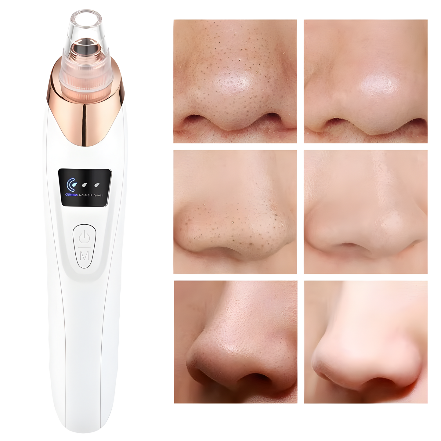 Blackhead Remover Vacuum