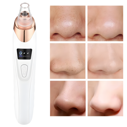 Blackhead Remover Vacuum